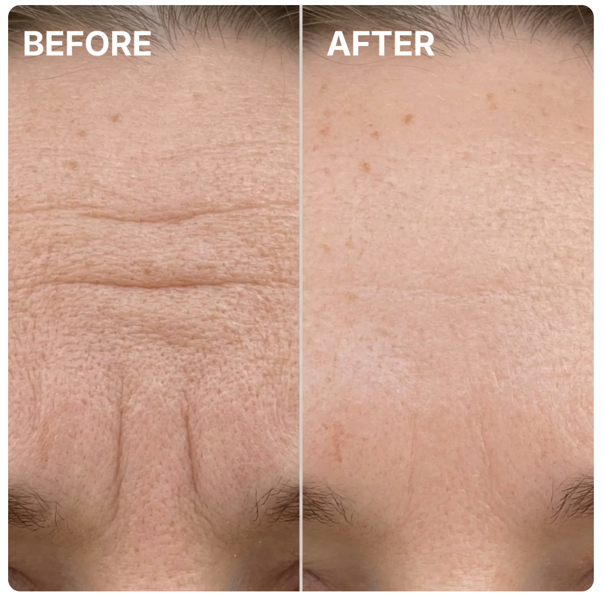 LUNORIA PDRN Pink Collagen Volume Multi Balm